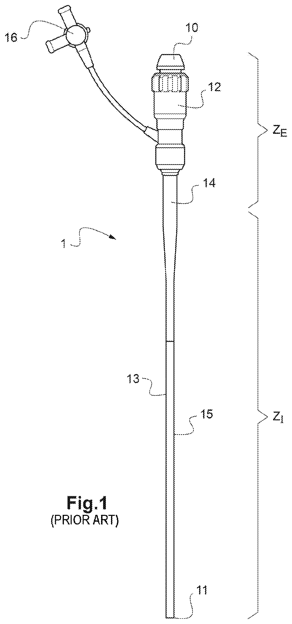 Assembly for placement of a cardiac, aortic or arterial implant with stimulation assistance by a peripheral venous or arterial catheter