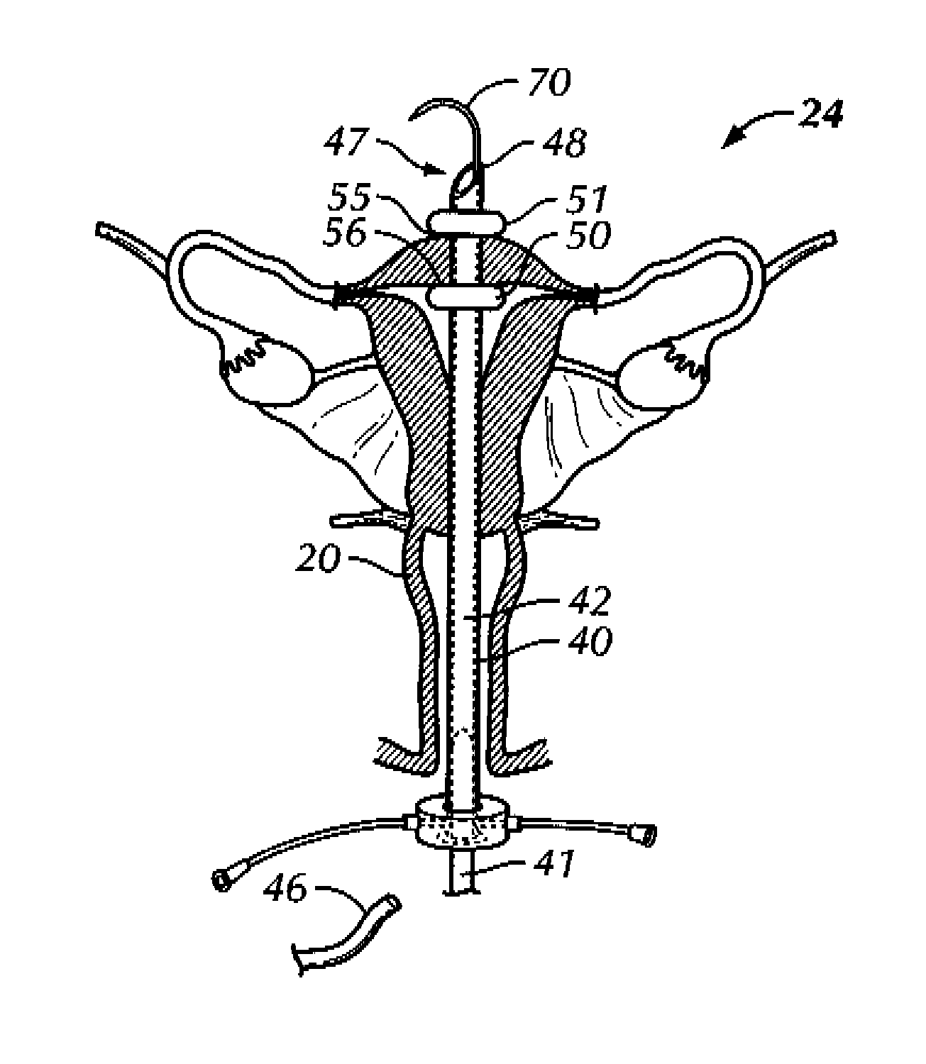 Methods and apparatus for natural orifice vaginal hysterectomy