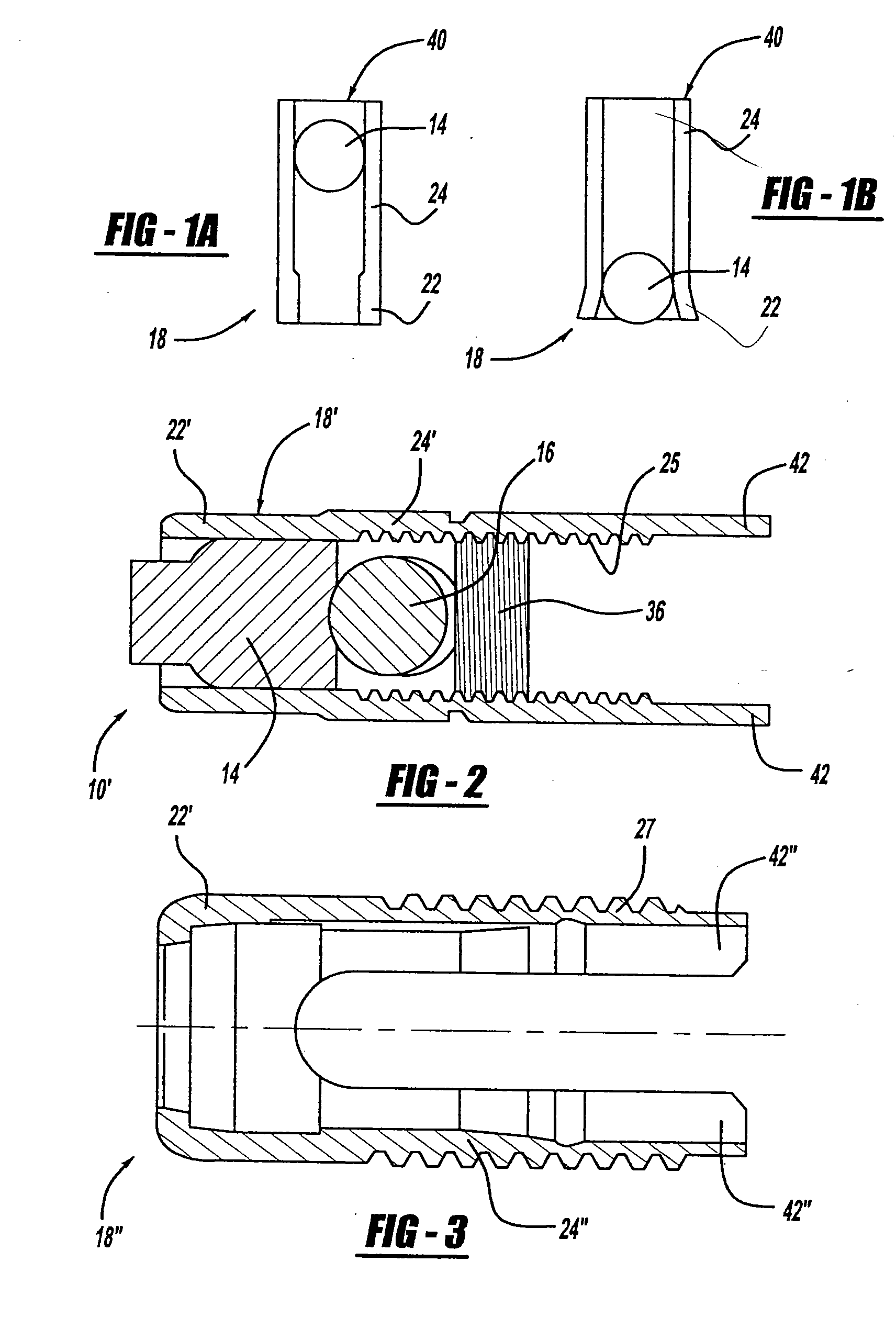 Screw and rod fixation assembly and device