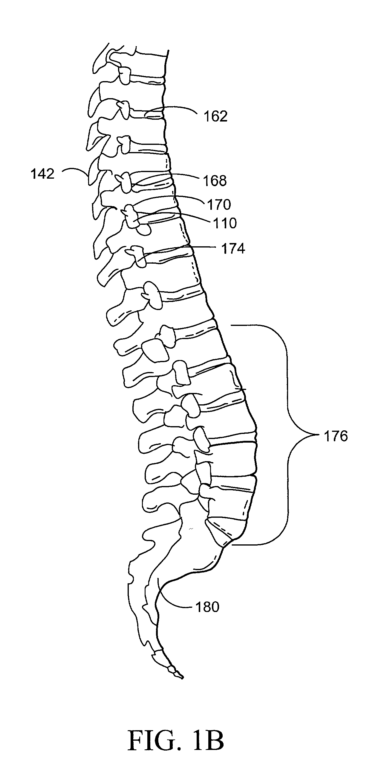 Apparatus and method for accessing and performing a function within an intervertebral disc