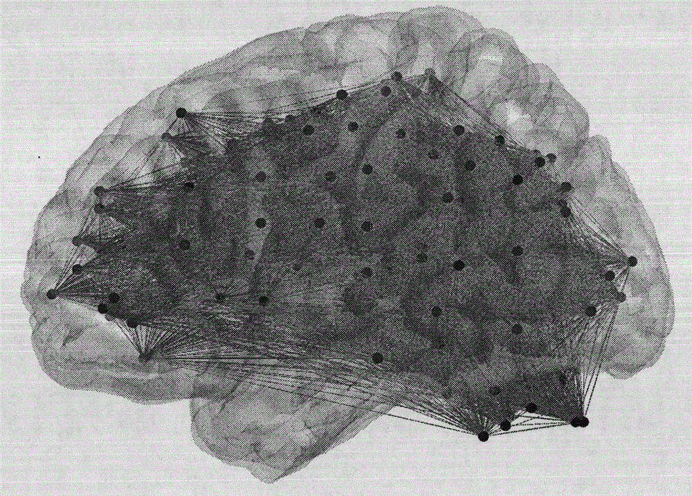 A Brain Network Construction Method Fused with Image Voxels and Prior Brain Atlas Partitioning