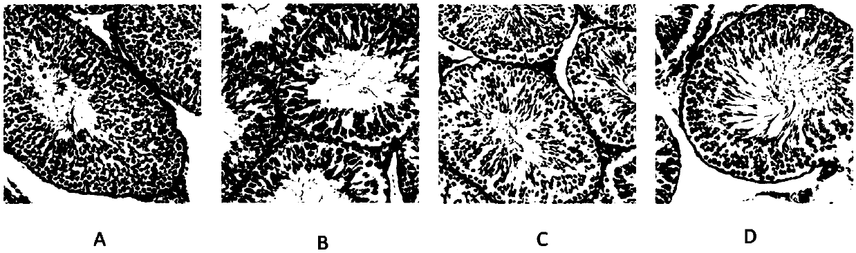 Application of composite amino acid in preparing medicine for treating oligoasthenozoospermia