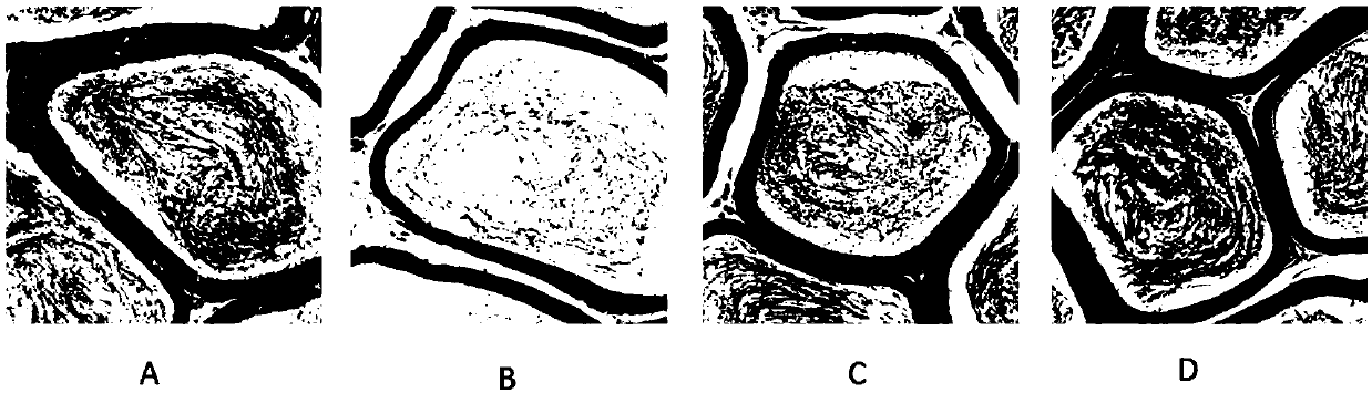 Application of composite amino acid in preparing medicine for treating oligoasthenozoospermia