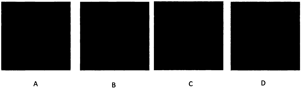 Application of composite amino acid in preparing medicine for treating oligoasthenozoospermia