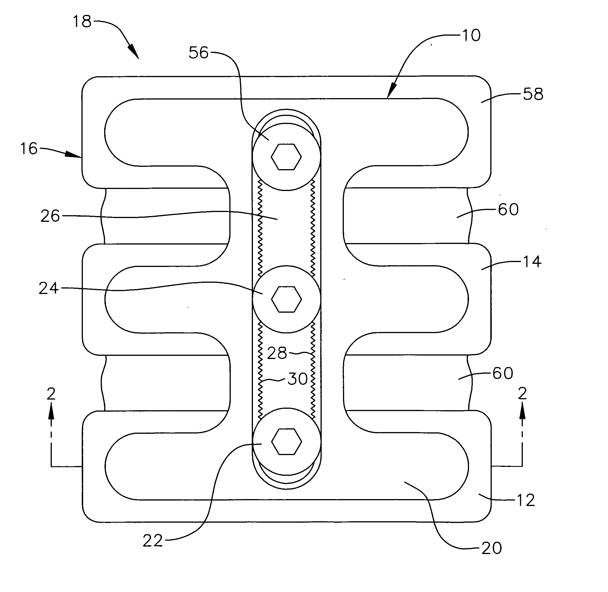 Spinal-column buttress plate assembly and method for attachment
