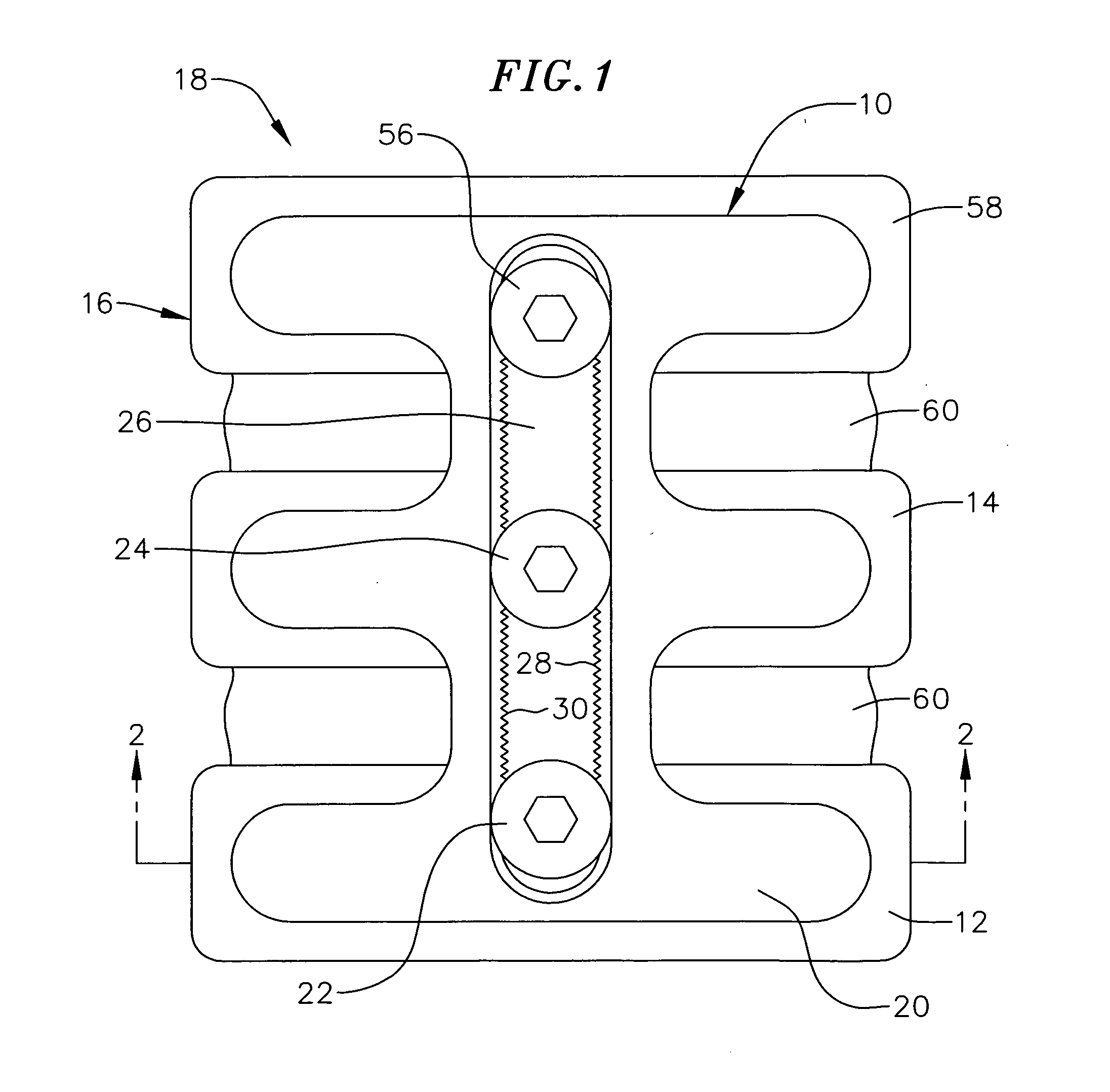 Spinal-column buttress plate assembly and method for attachment