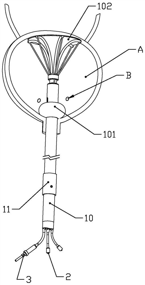 An oncology bladder drug delivery device