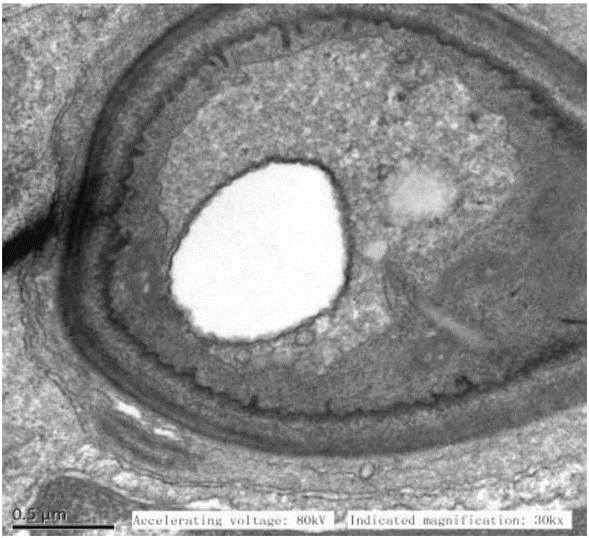 Application of cinnamaldehyde in preparation of drugs for targeted therapy of drug-resistant monilial infection