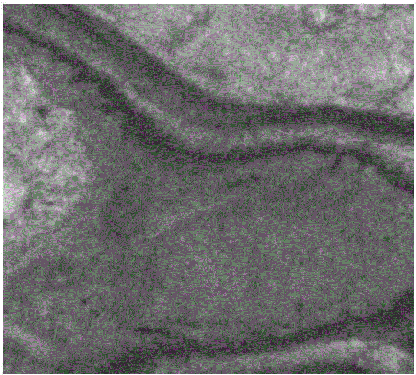 Application of cinnamaldehyde in preparation of drugs for targeted therapy of drug-resistant monilial infection