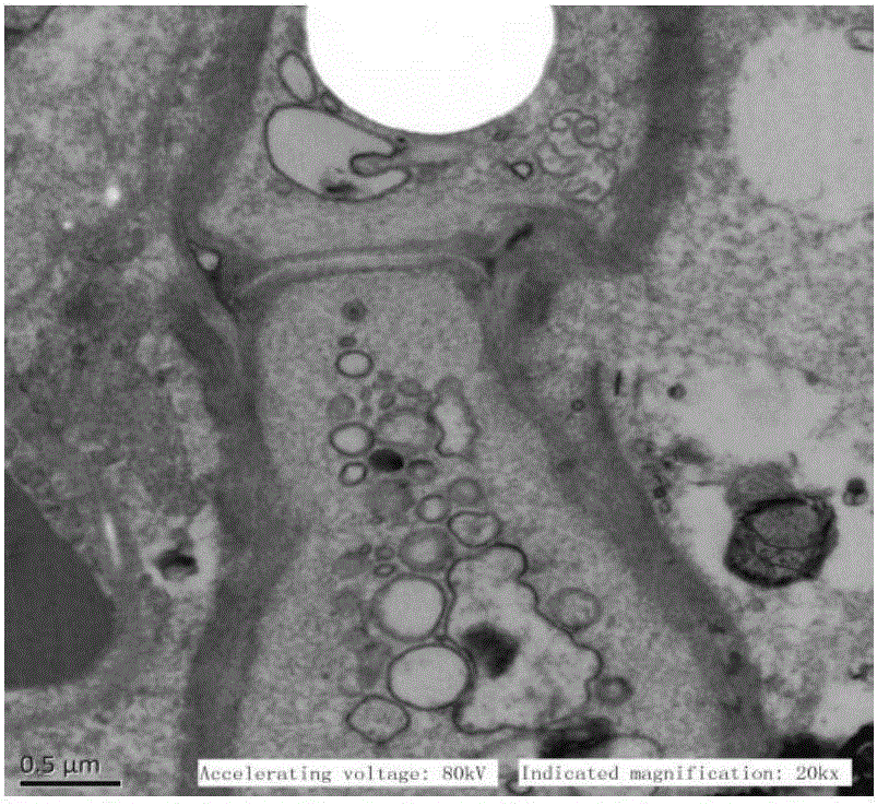 Application of cinnamaldehyde in preparation of drugs for targeted therapy of drug-resistant monilial infection