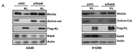 A method for analyzing the role of Rab8 in regulating Klotho expression in non-small cell lung cancer