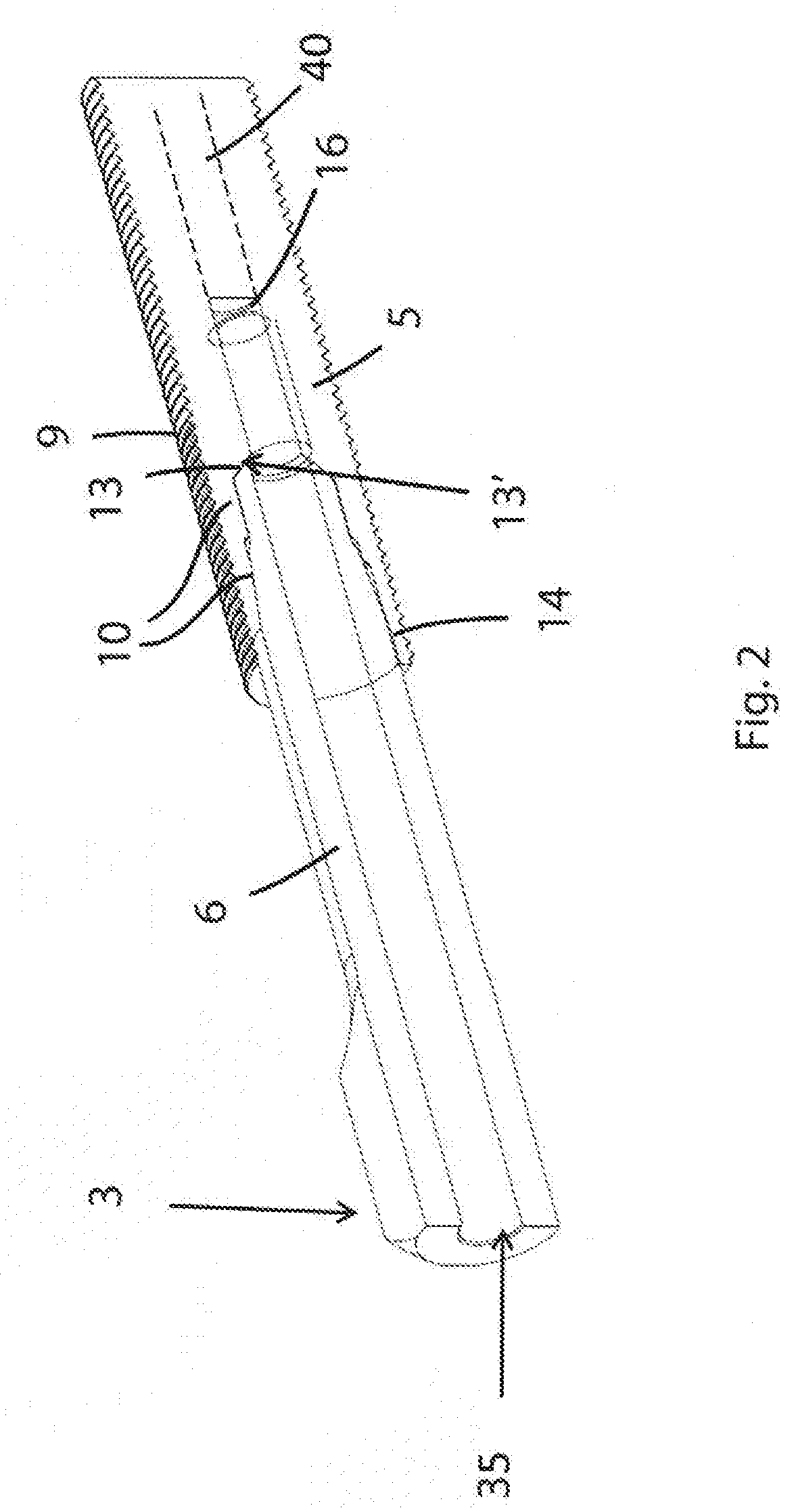 Anchoring system for attaching a prosthesis to a human body