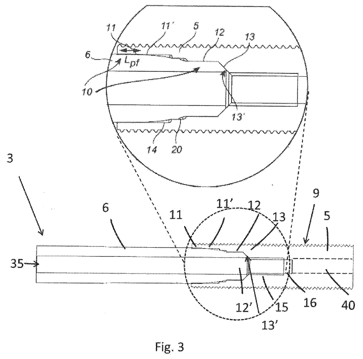 Anchoring system for attaching a prosthesis to a human body