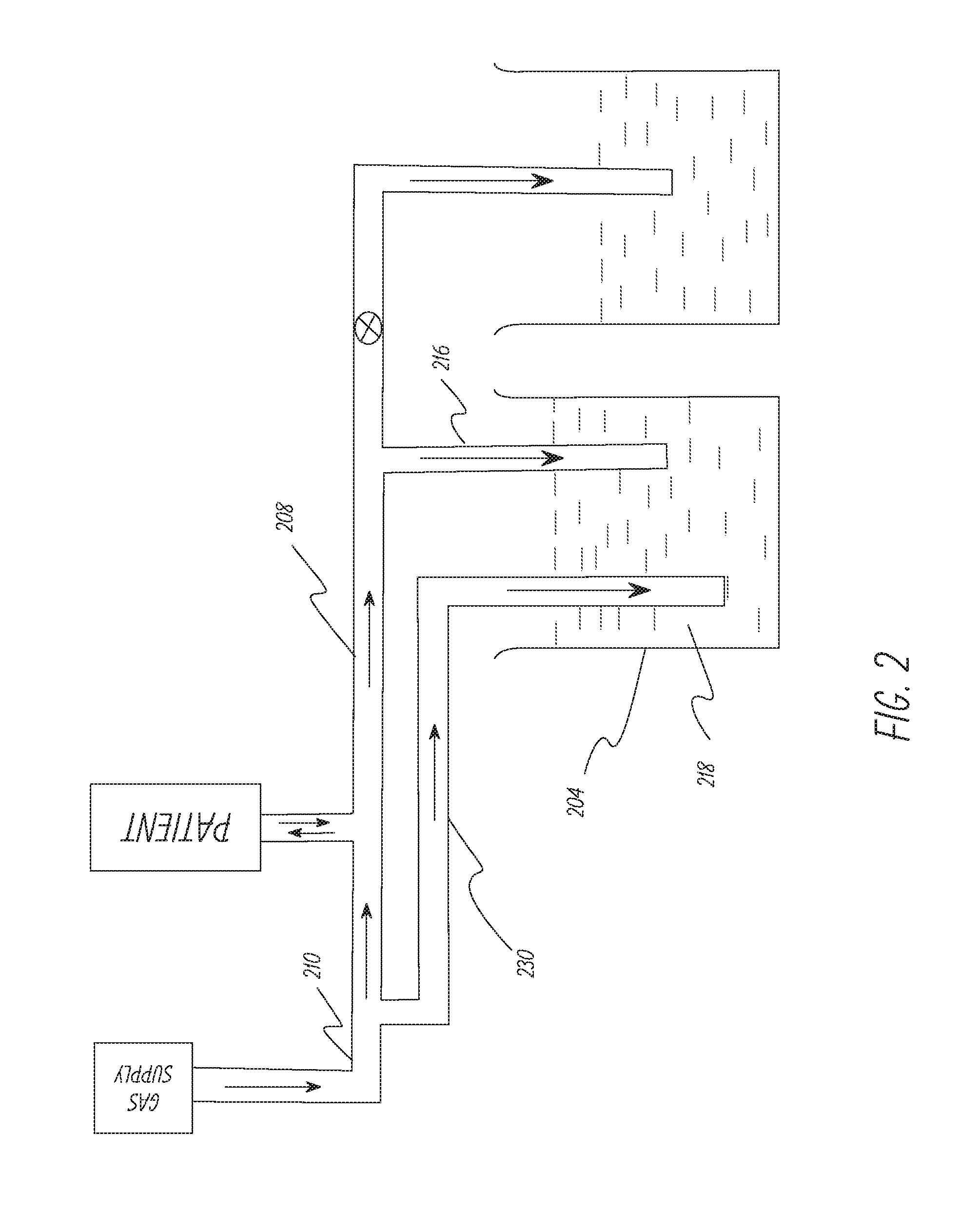 Apparatus and method to provide breathing support