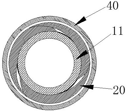 a balloon catheter