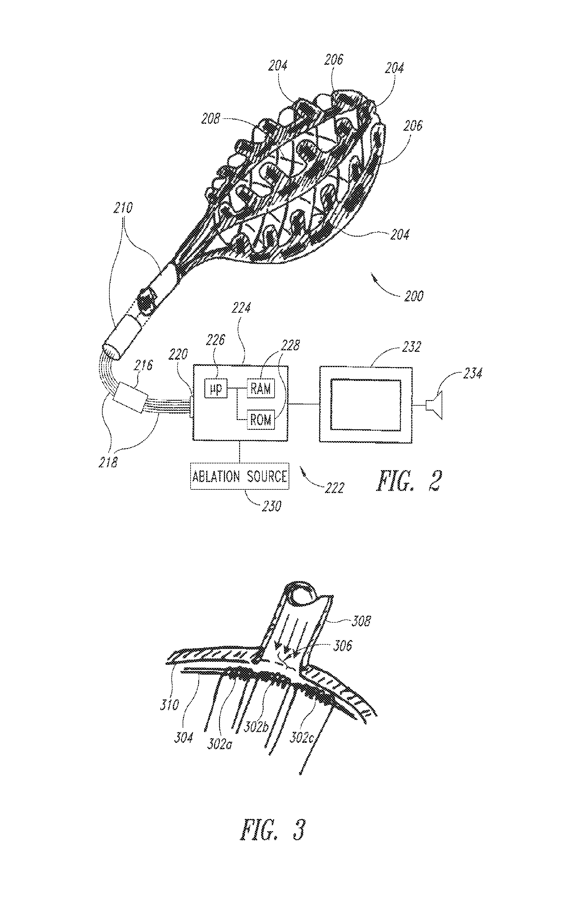 Medical device for use in bodily lumens, for example an atrium