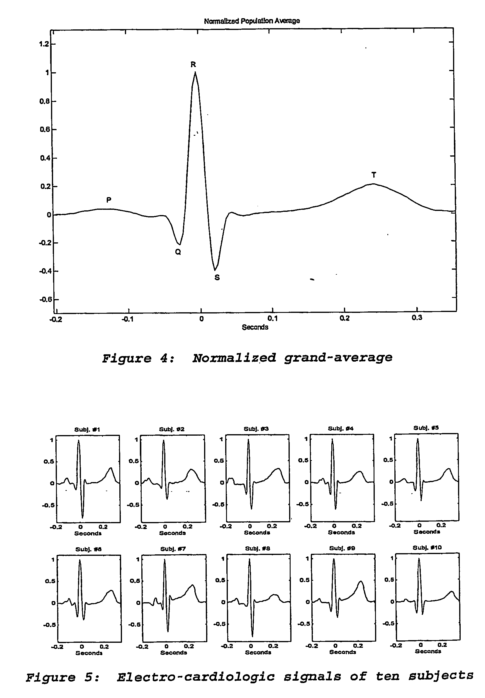 Method and apparatus for electro-biometric identiy recognition