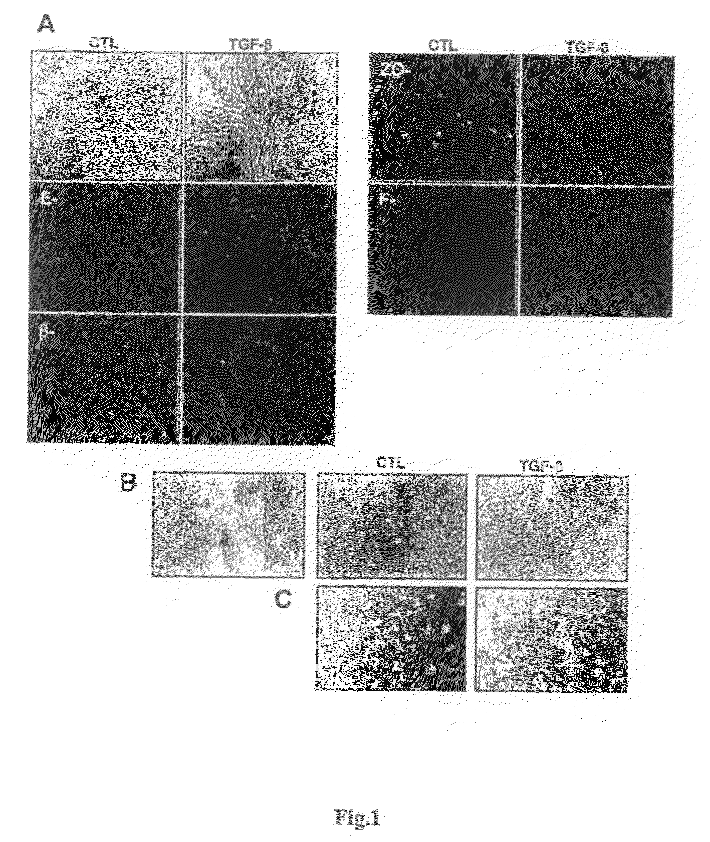 Methods and compositions for modulating tumor cell activity