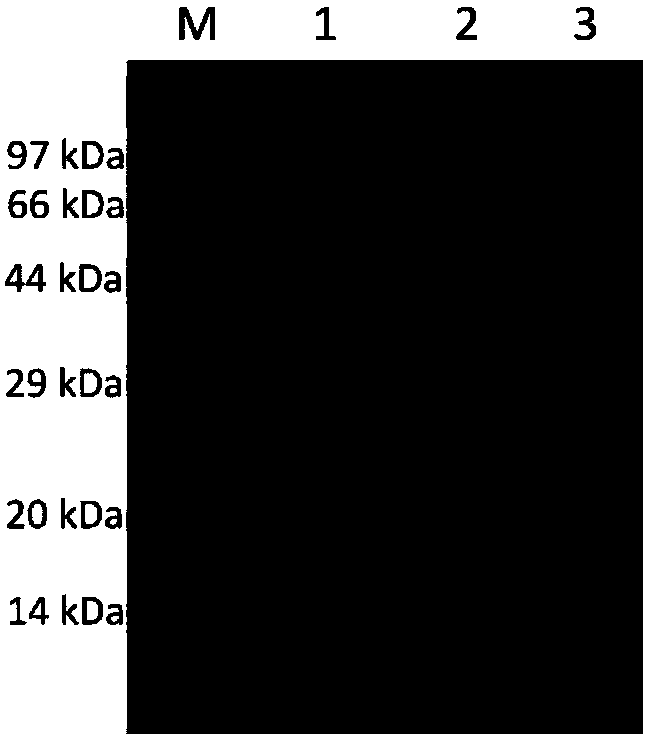 Monoclonal antibody against human lp-pla2 protein resistant to lipoprotein interference and its application