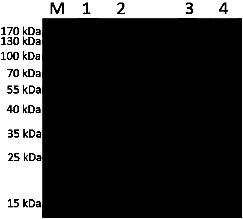 Monoclonal antibody against human lp-pla2 protein resistant to lipoprotein interference and its application