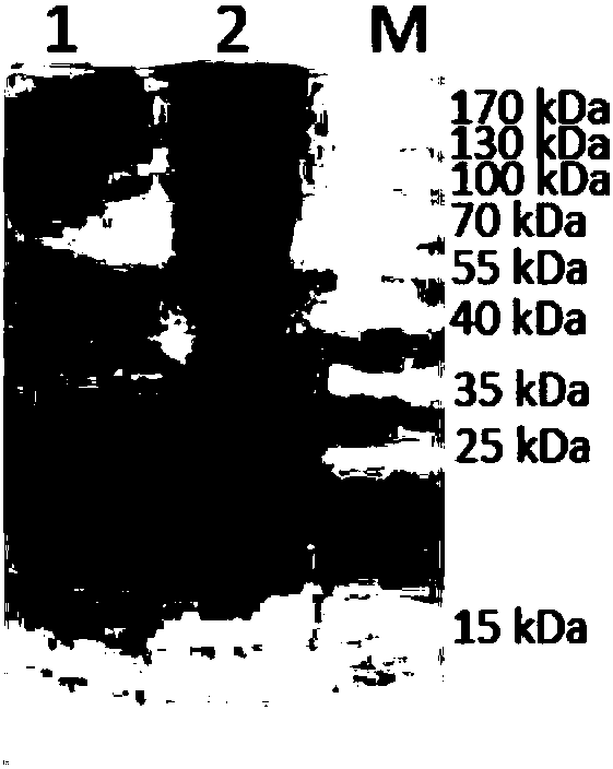 Monoclonal antibody against human lp-pla2 protein resistant to lipoprotein interference and its application