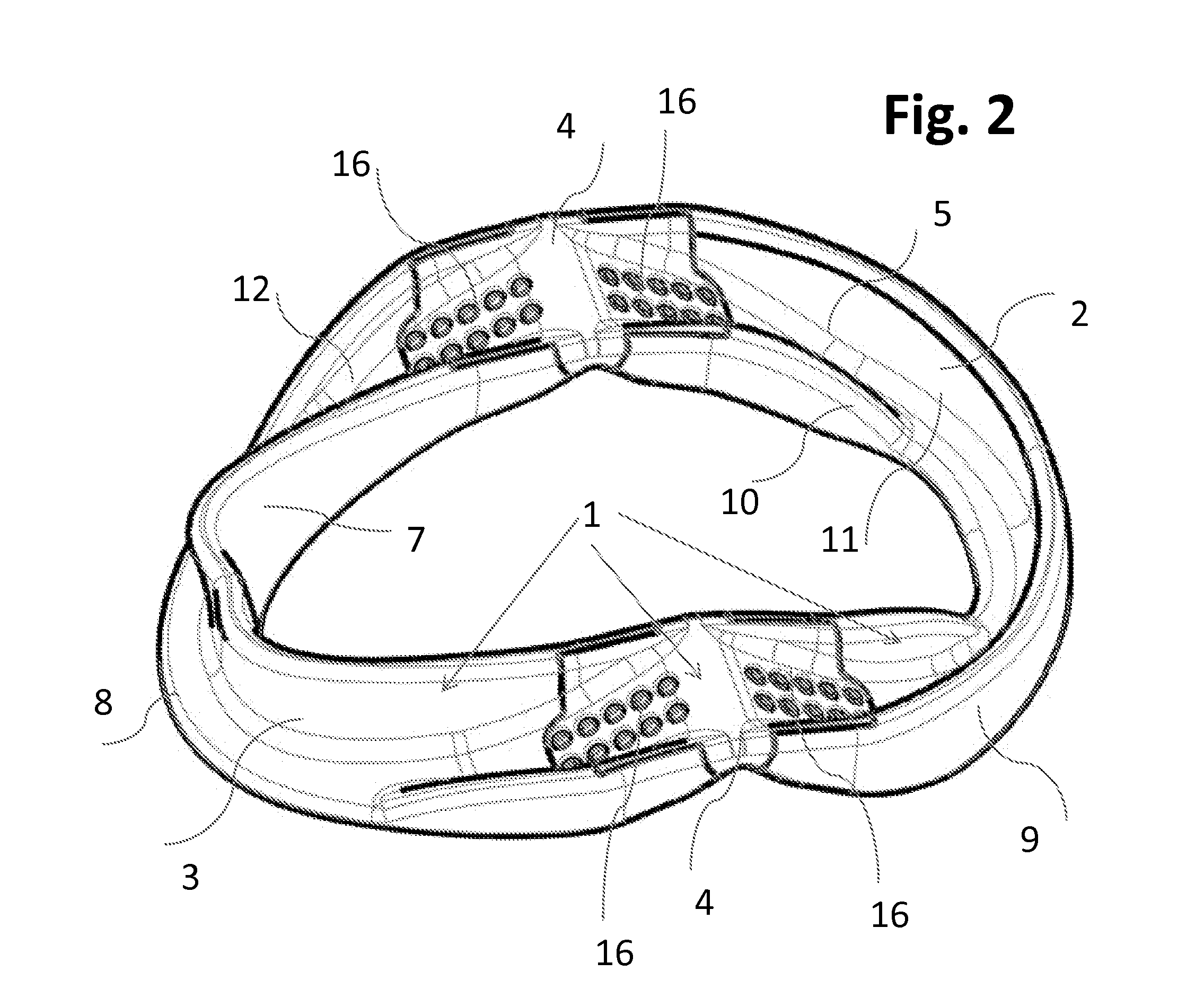 Incremental and/or successive adjustable mandibular advancement device for preventing and treatment of snoring and obstructive sleep apnea