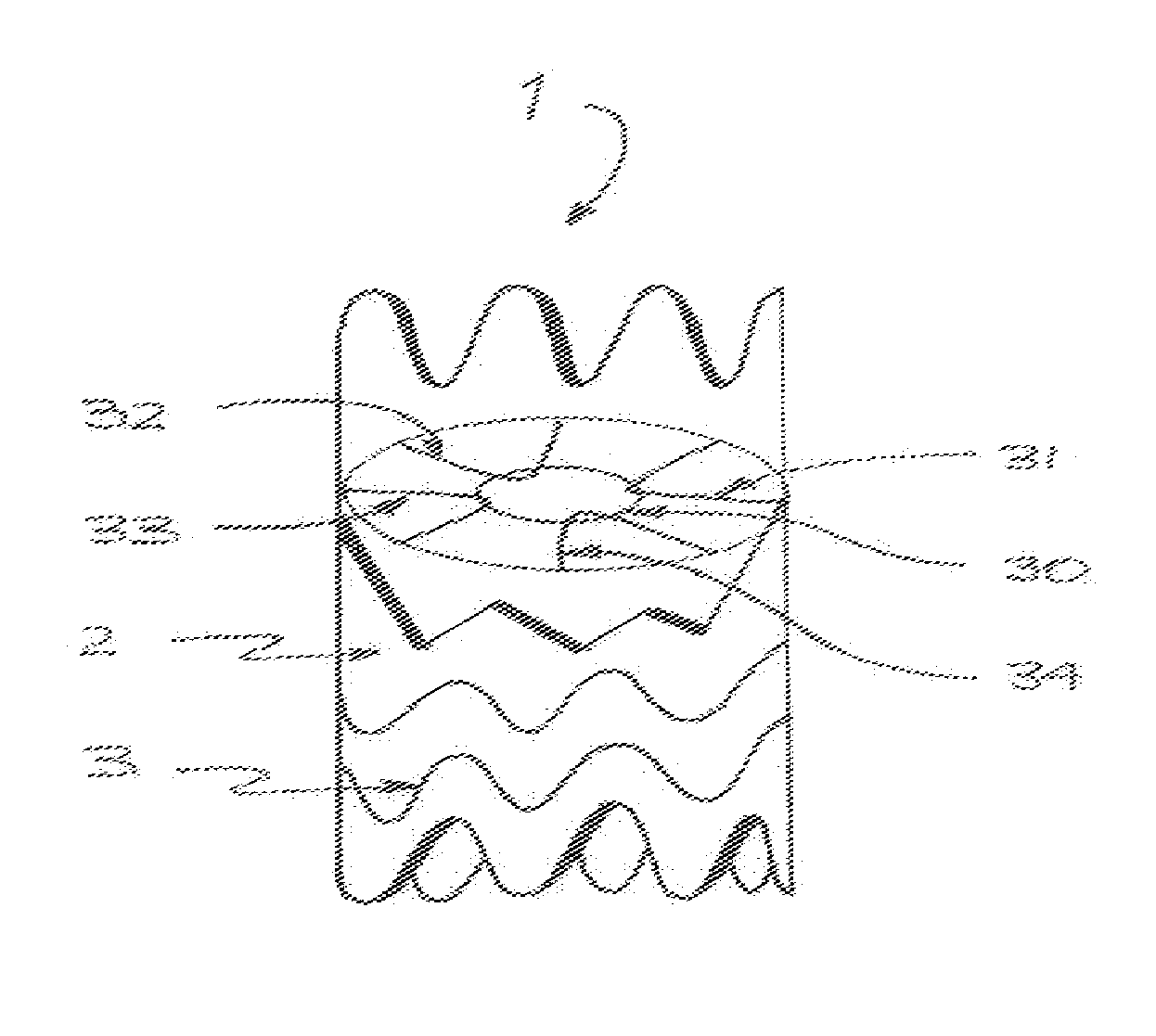 Vascular filter stent