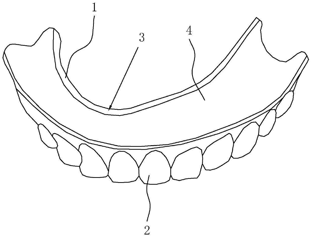 Removable denture and manufacturing technology thereof
