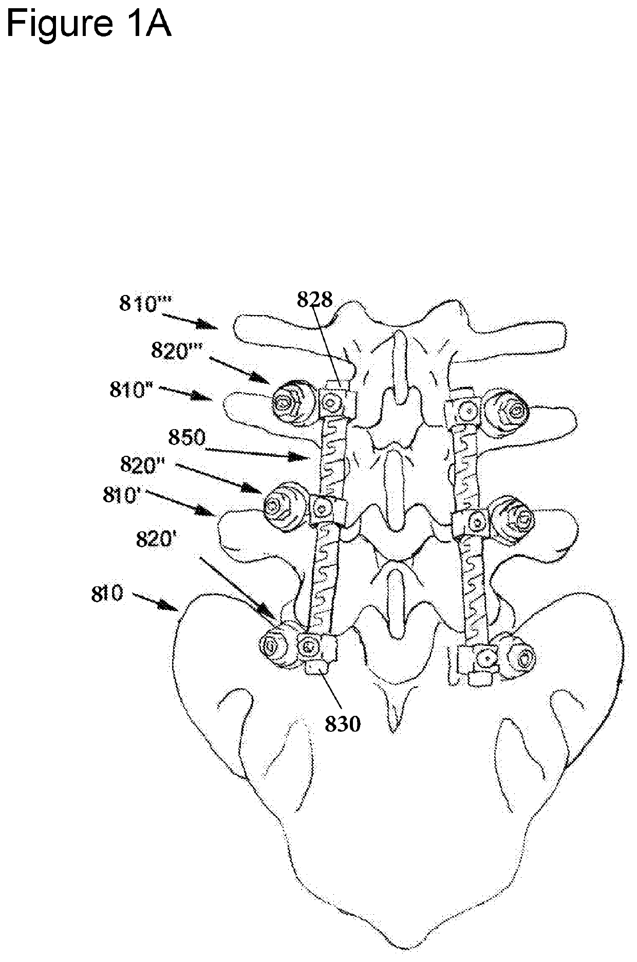 Flexible spine components having multiple slots