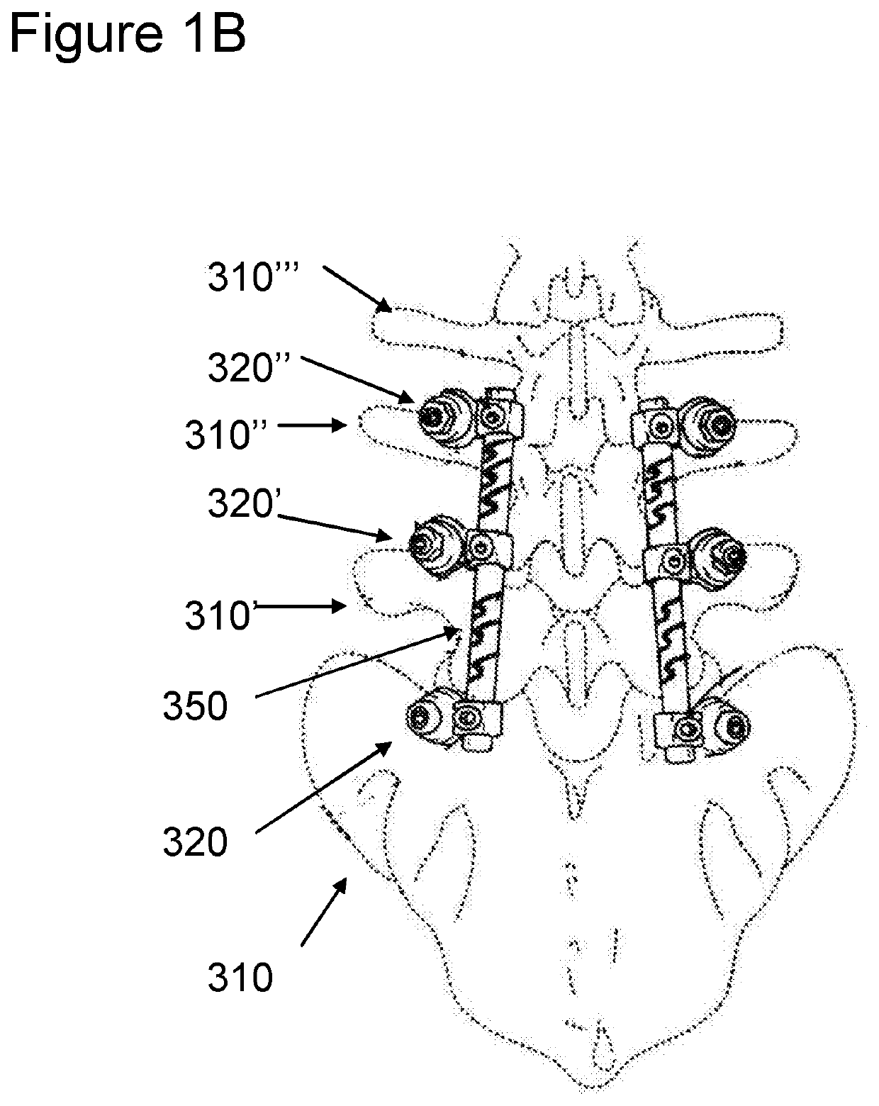 Flexible spine components having multiple slots