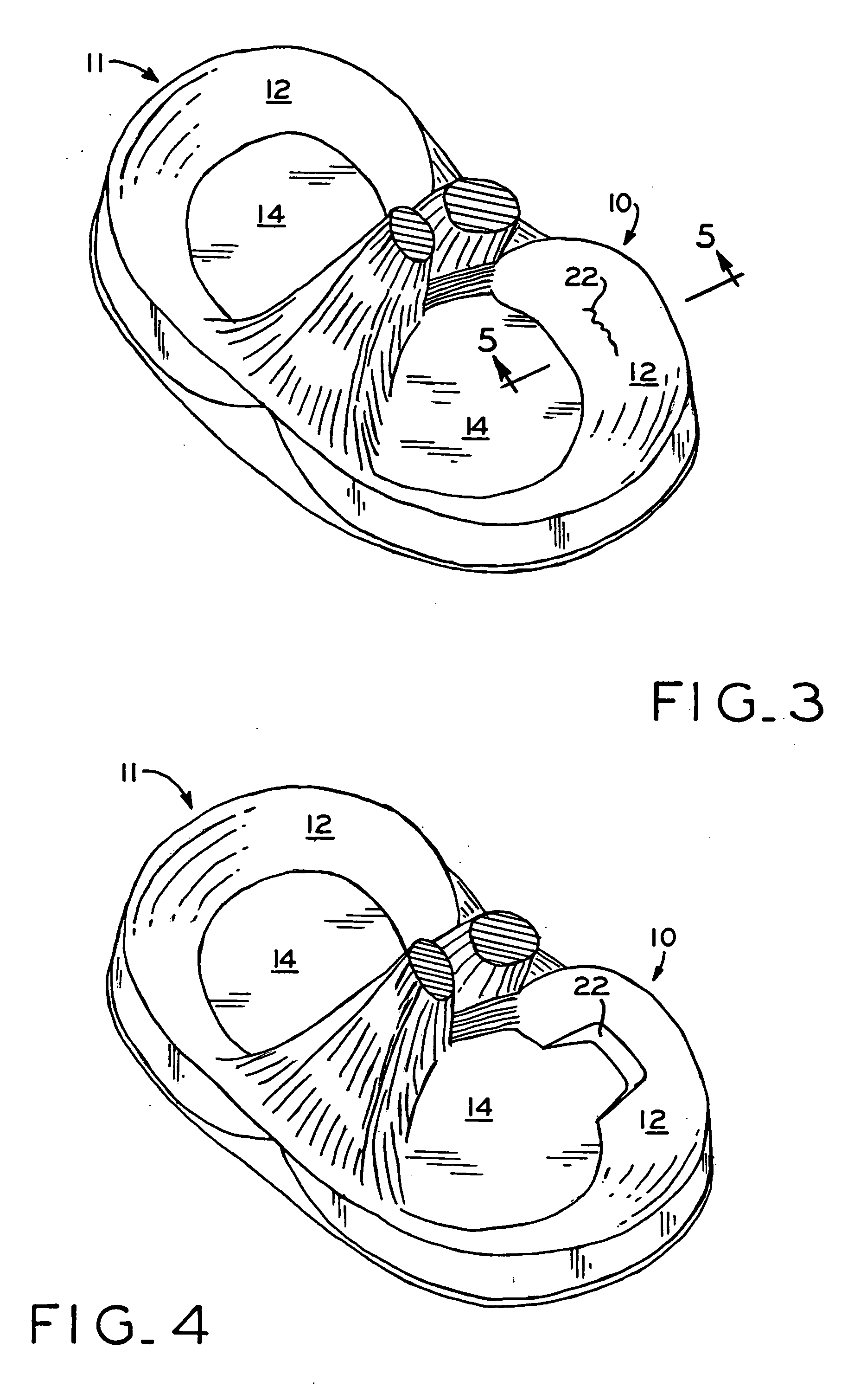Medical device for repair of tissue and method for implantation and fixation