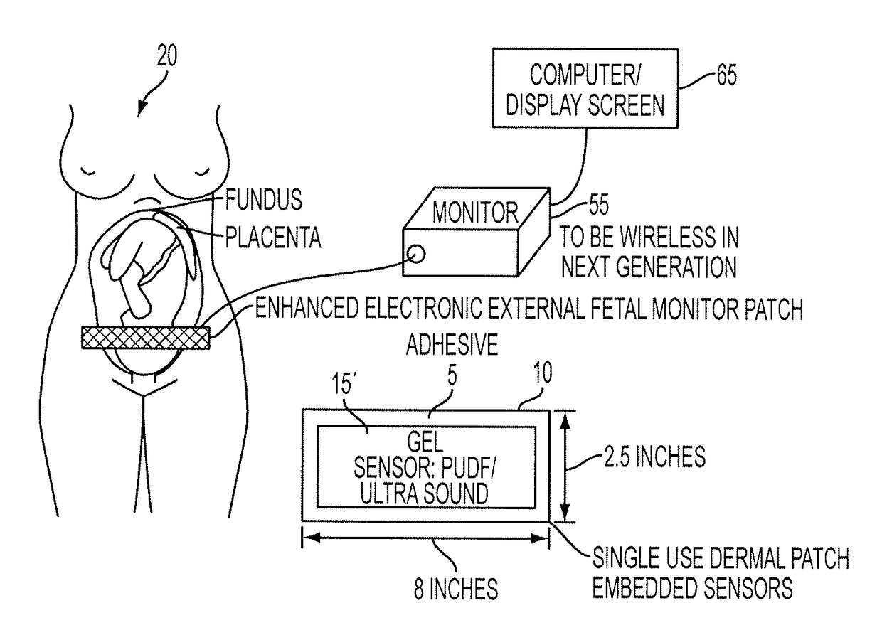 Enhanced electronic external fetal monitoring system