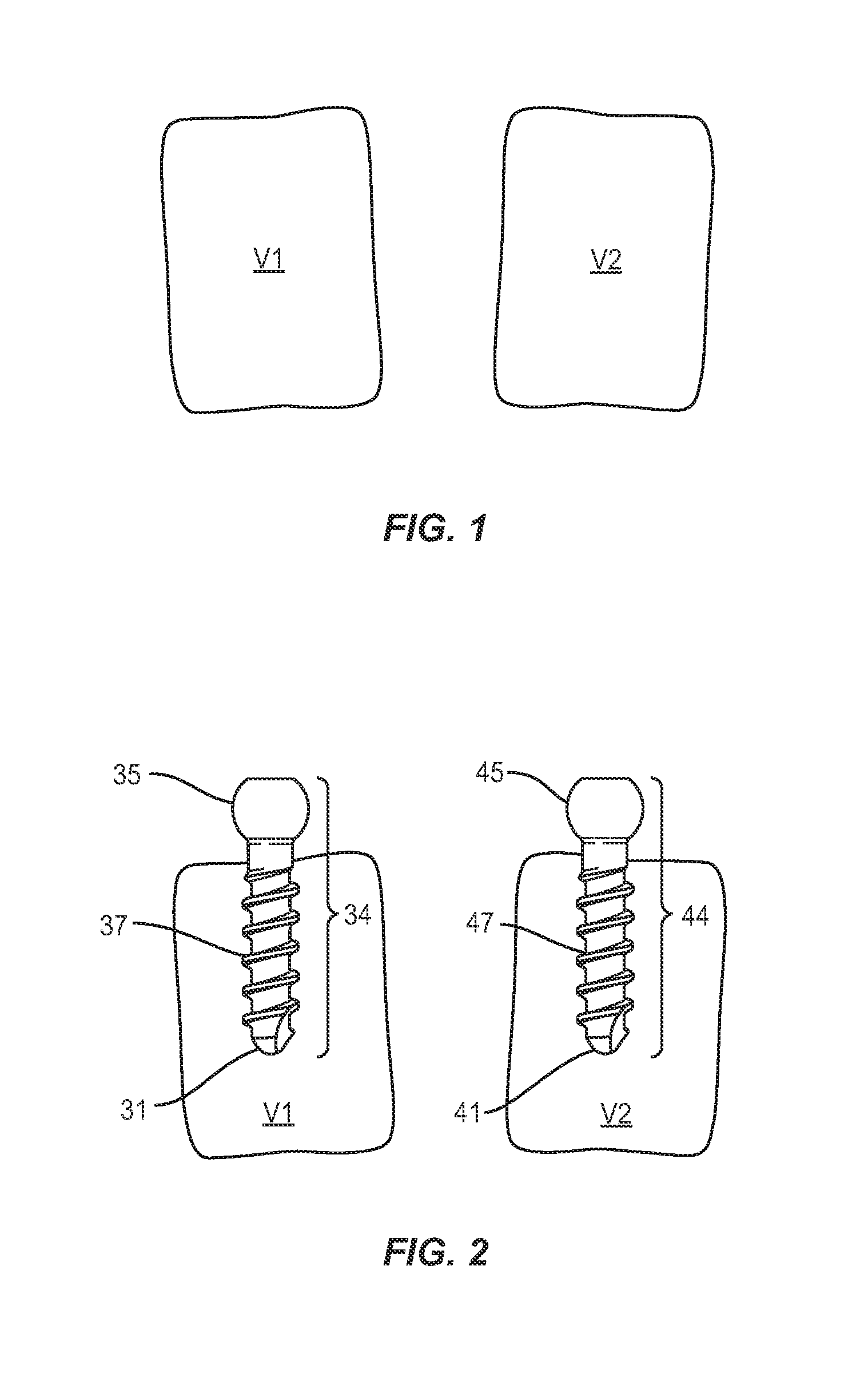 Spinal systems and methods for correction of spinal disorders