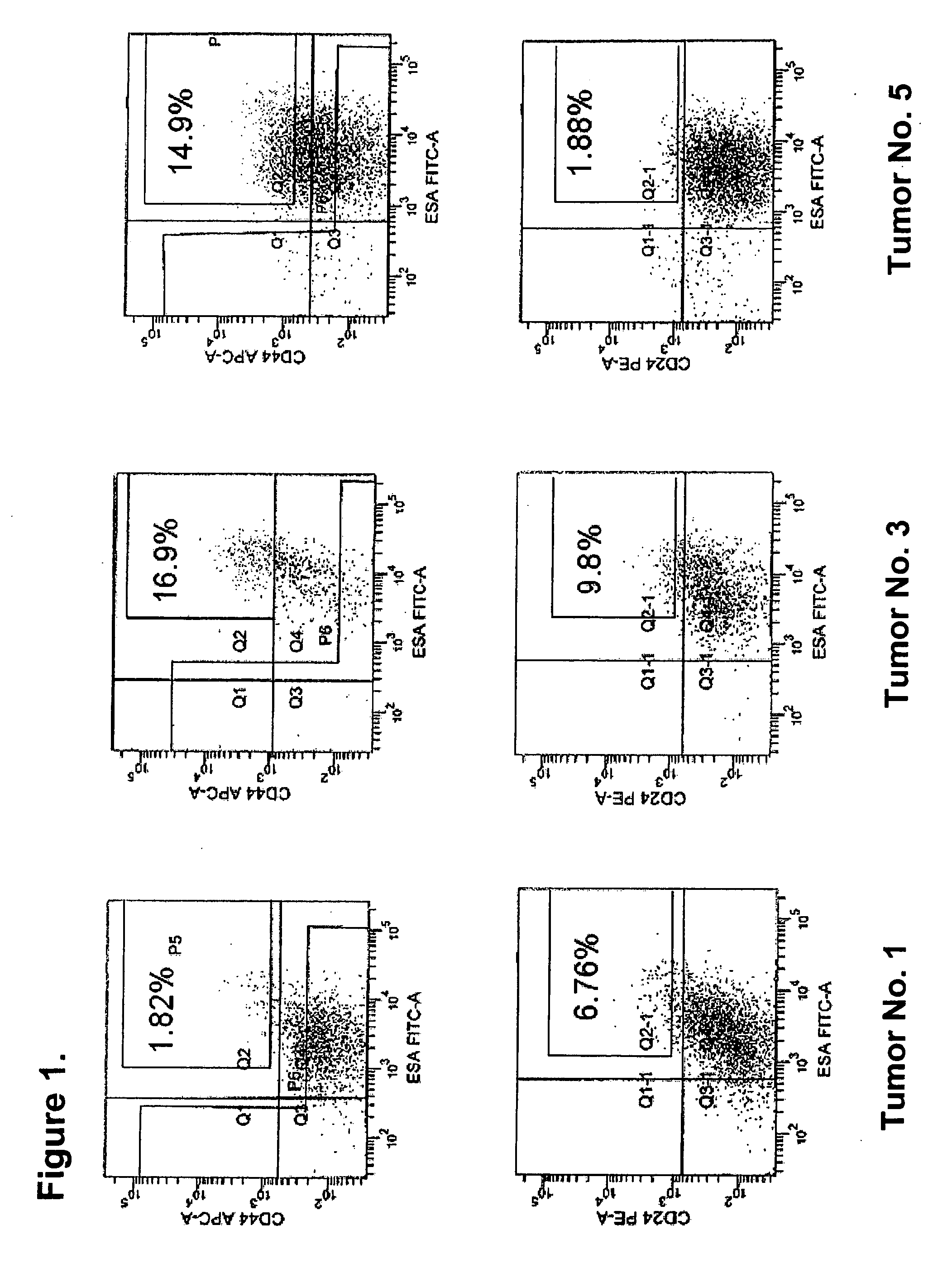 Compositions And Methods For Treating And Diagnosing Pancreatic Cancer