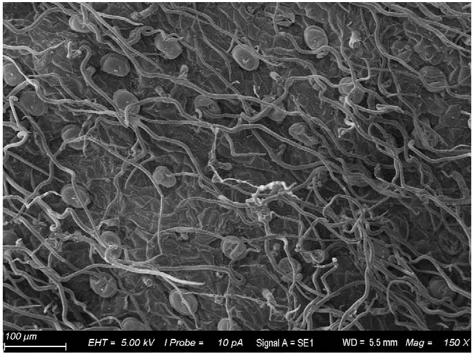 Fluorescent staining slide preparation method for observing forms of glandular hair and non-glandular hair of plant leaf epidermal hair