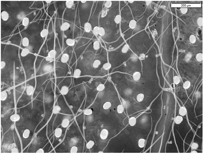 Fluorescent staining slide preparation method for observing forms of glandular hair and non-glandular hair of plant leaf epidermal hair