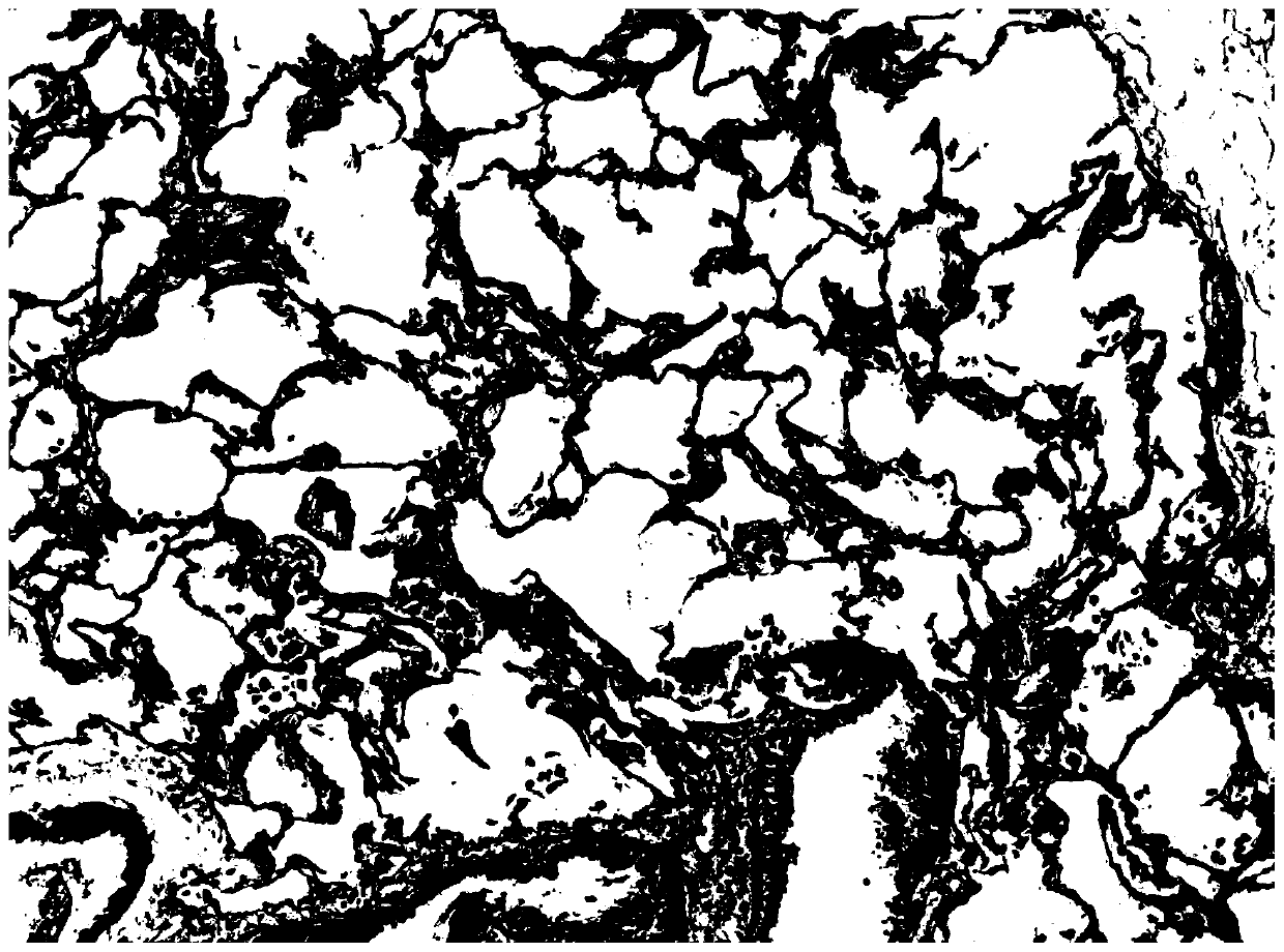 A traditional Chinese medicine composition for treating diffuse pulmonary fibrosis and its application