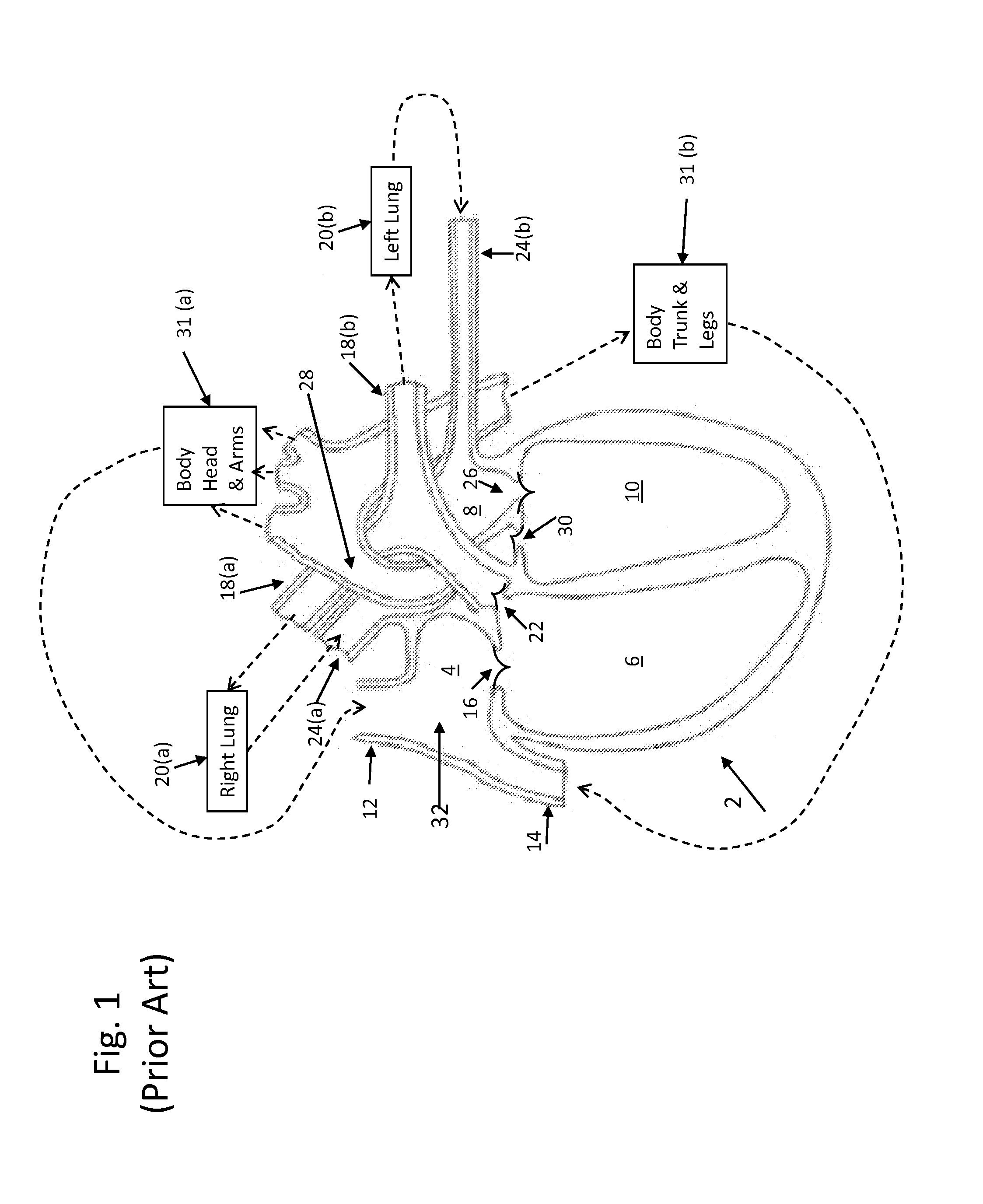System and method for monitoring cardiac output, flow balance, and performance parameters