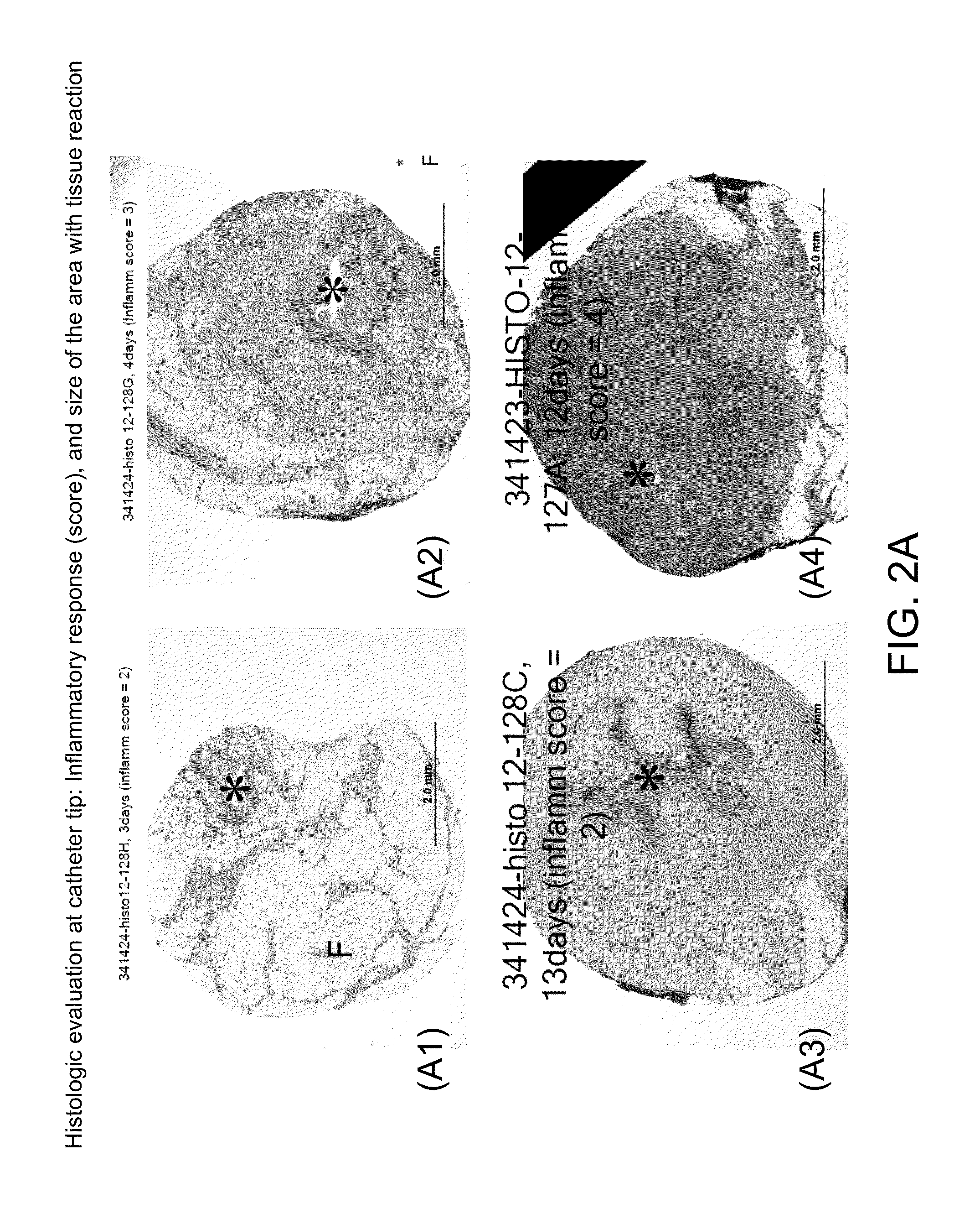Methods and systems for inhibiting foreign-body responses in diabetic patients