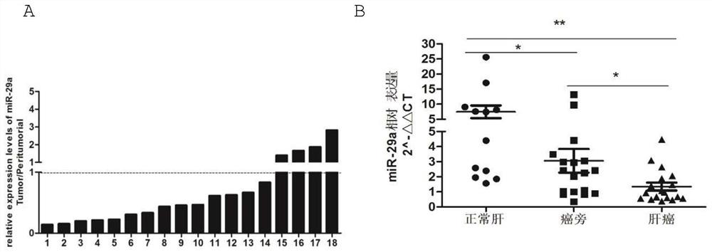 Application of mir-29a gene in detecting liver cancer and liver fibrosis, and construction method of gene conditional knock-in mice