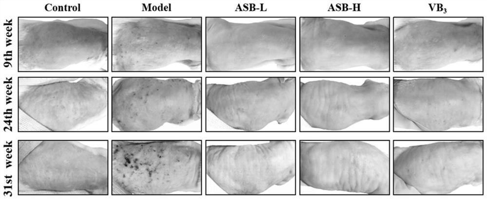 Application of sodium bisulfite andrographolide in preparation of drug or sunscreen for preventing and treating light-induced skin injury disease
