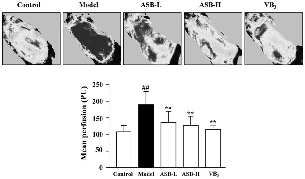 Application of sodium bisulfite andrographolide in preparation of drug or sunscreen for preventing and treating light-induced skin injury disease