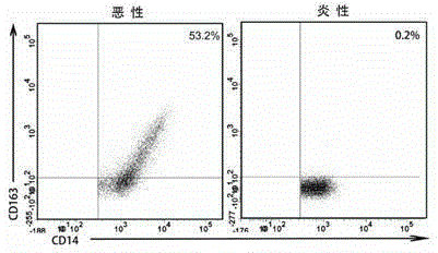 A method for identifying malignant pleural effusion