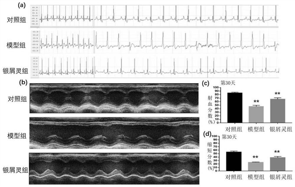 Application of traditional chinese medicine for treating psoriasis in preparation of medicine for preventing and treating myocardial ischemia-reperfusion injury