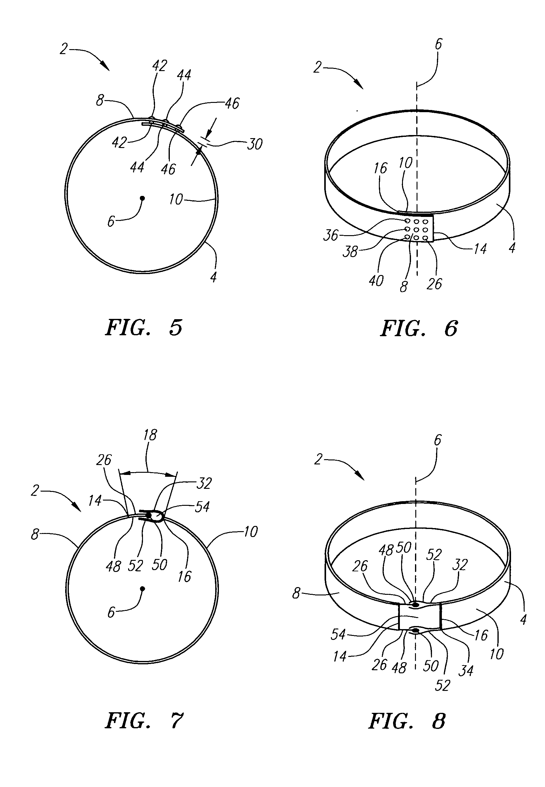 Biologically implantable prosthesis and methods of using the same