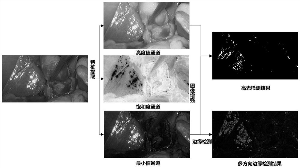 Endoscopic image highlight removal method based on non-convex low-rank matrix decomposition