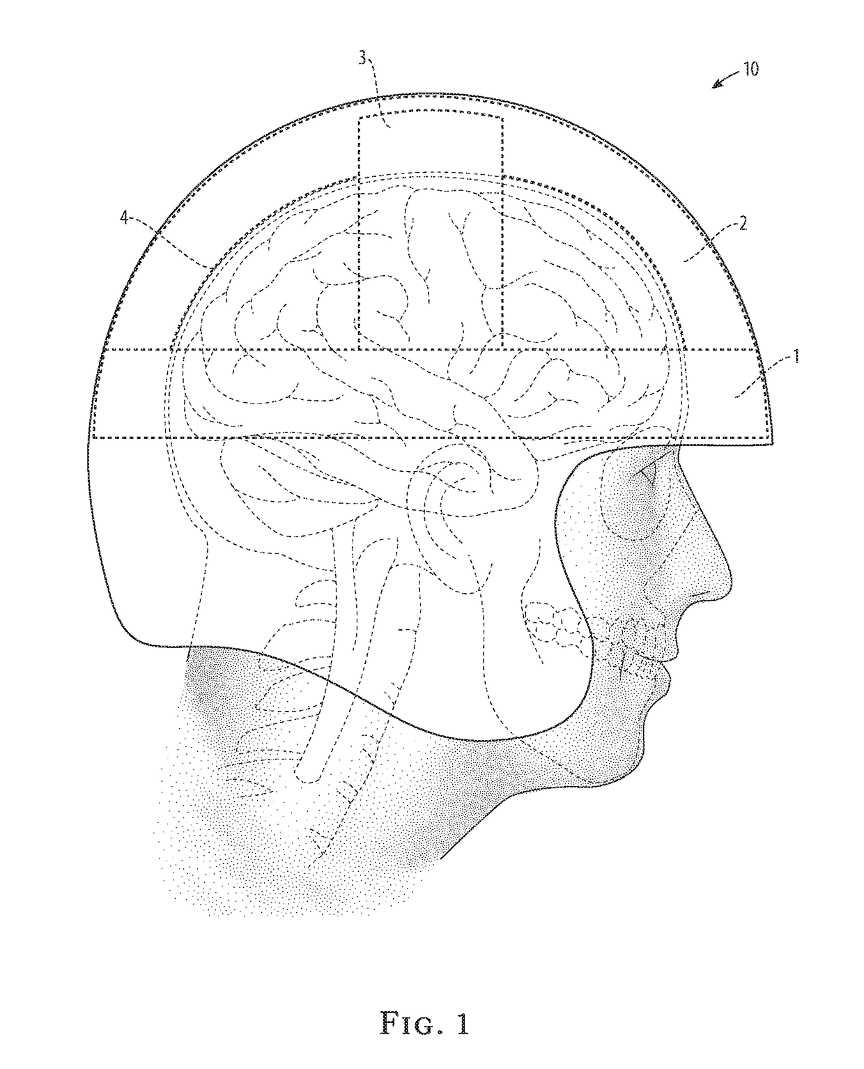 Brain-protecting helmet lining apparatus and method