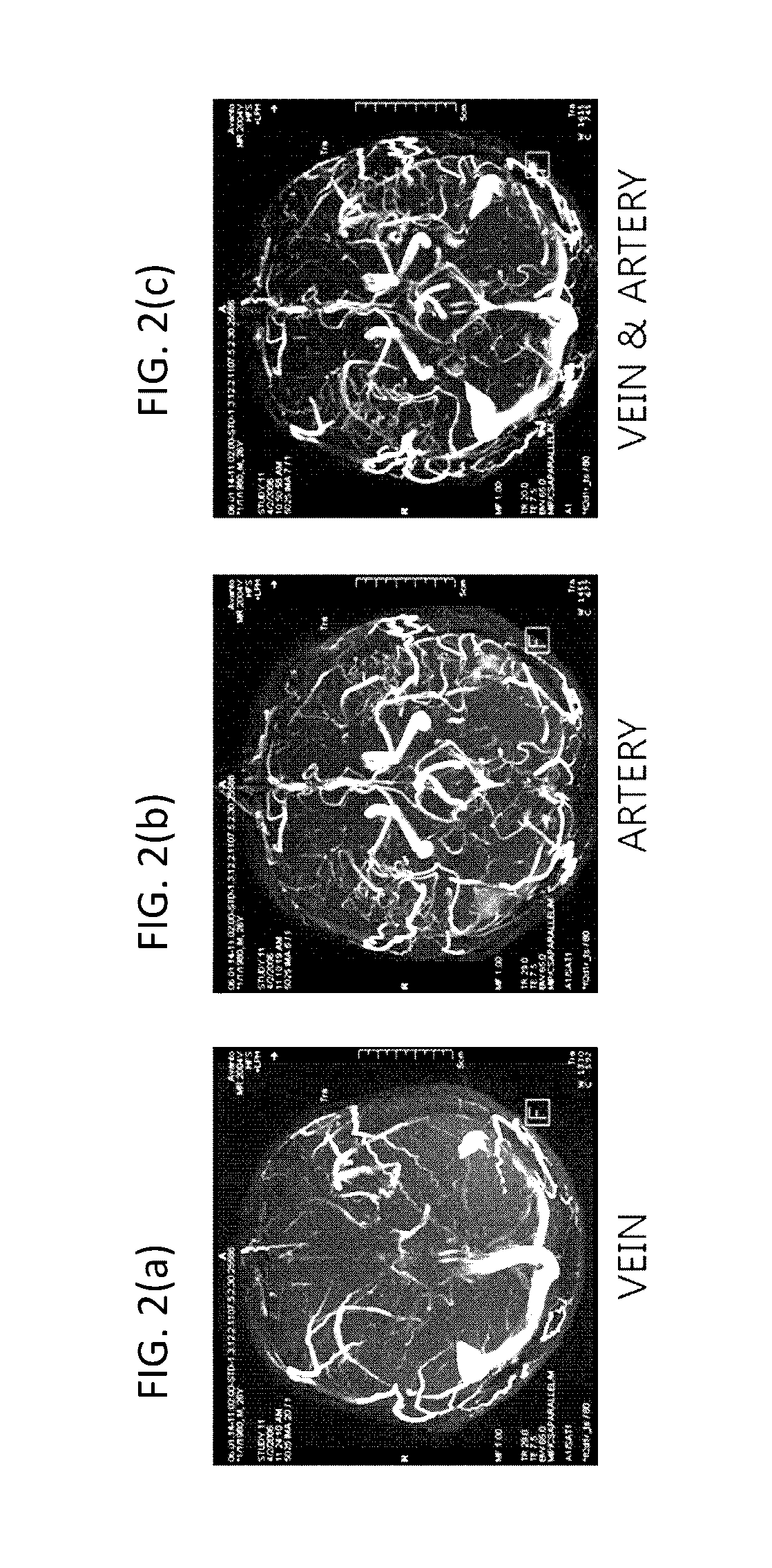Method for acquiring t2* and vascular images from magnetic resonance imaging system