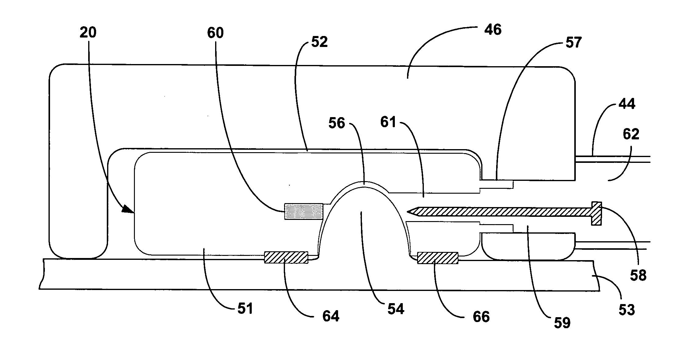 Intra-luminal device for gastrointestinal electrical stimulation