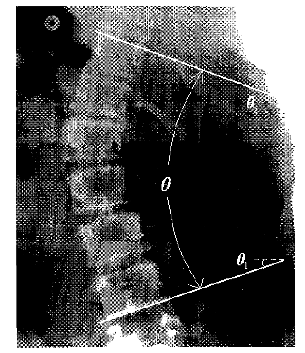 Scoliosis X-ray image-assisted diagnostic system and method thereof